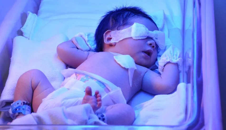 Yeni Doğan Bebekte Sarılık Nedir, Nasıl Bulaşır?